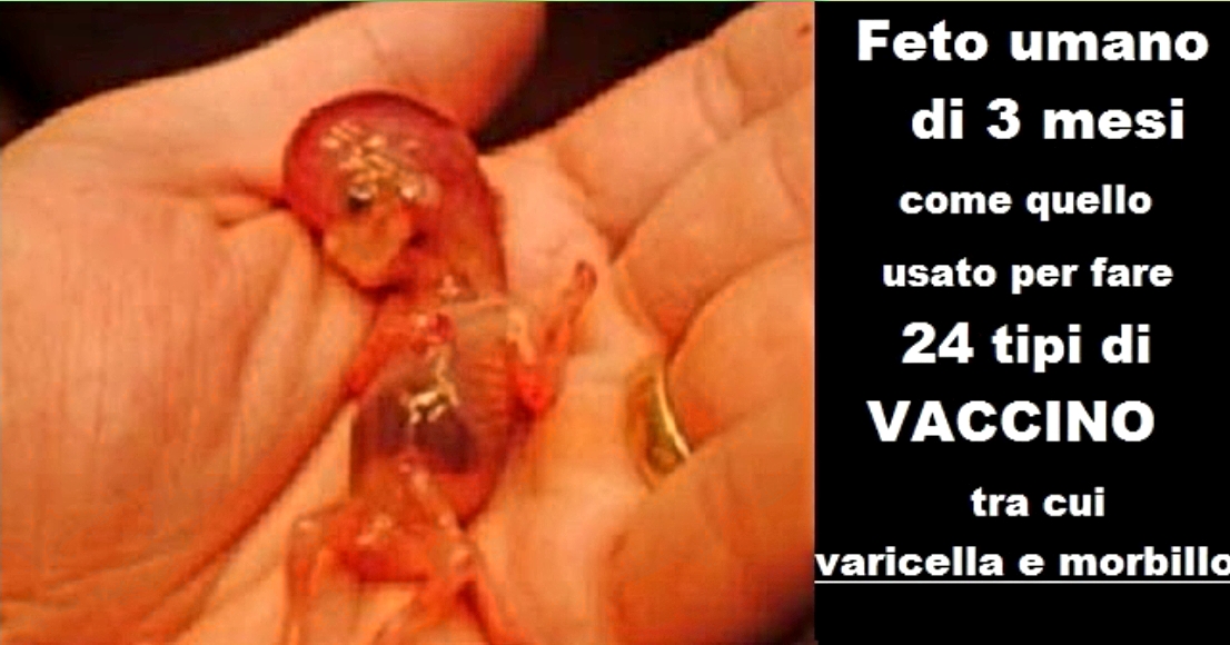 I BIOLOGI: “VACCINI SPORCHI” CON DISERBANTI E FETI ABORTITI